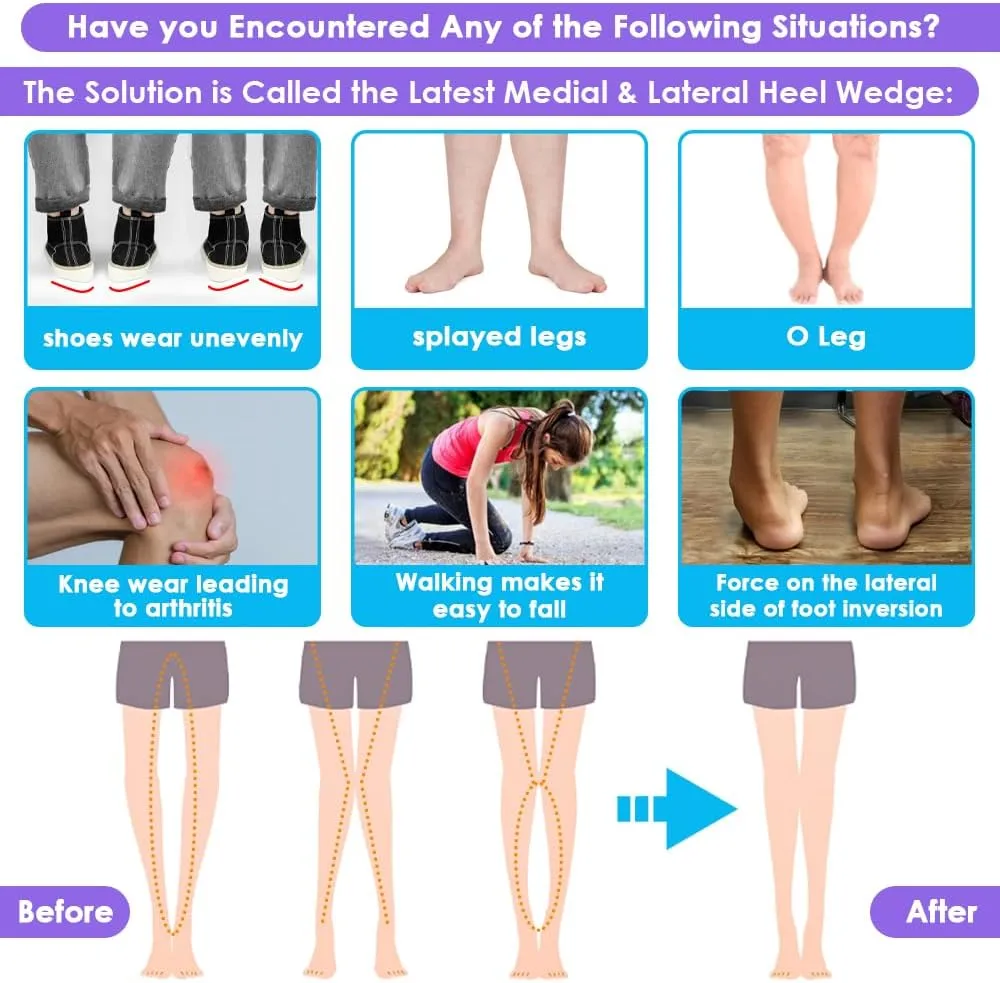 3 Layers Adjustable Supination Overpronation Insoles, Anti-Slip Medial Lateral Heel Wedge Insoles for Foot Alignment, Knee Pain, Bow Legs, Osteoarthritis (Clear, S: W 4-7.5/ M 6-7)