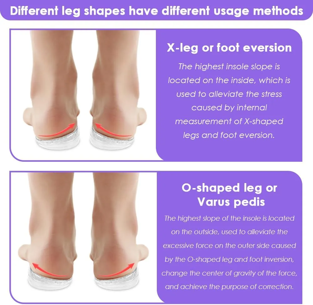3 Layers Adjustable Supination Overpronation Insoles, Anti-Slip Medial Lateral Heel Wedge Insoles for Foot Alignment, Knee Pain, Bow Legs, Osteoarthritis (Clear, S: W 4-7.5/ M 6-7)