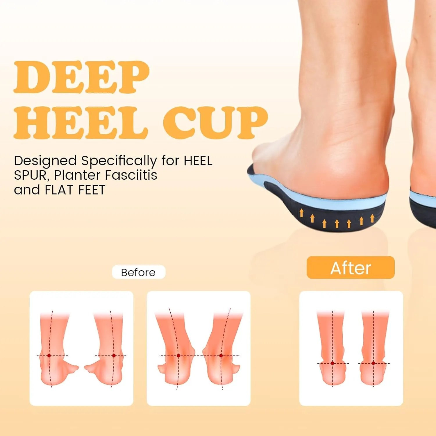 Anti-Fatigue Plantar Fasciitis Shoe Insoles Orthotic Arch Support Inserts for Women Men Flat Feet Work Boot Insoles for Arch Pain Relief (Mens 6-7/ Womens 8-9)